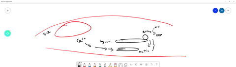 when-a-vertebrate-dies-its-muscles-stiffen-as-they-are-deprived-of-atp-a-state-called-rigor-mortis-u