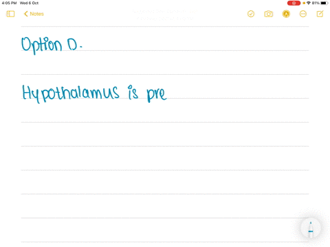 which-of-the-following-structures-is-found-in-diencephalon-a-pons-b-basal-ganglia-c-corpora-quadrige