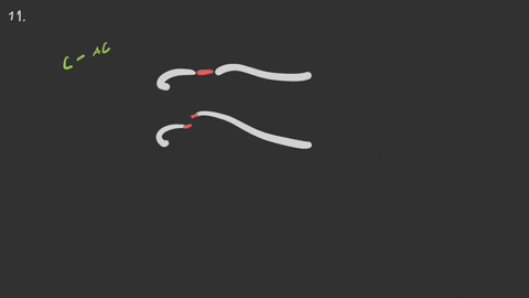a-shoulder-separation-results-from-injury-to-the-_____________-a-glenohumeral-joint-b-costoclavicula