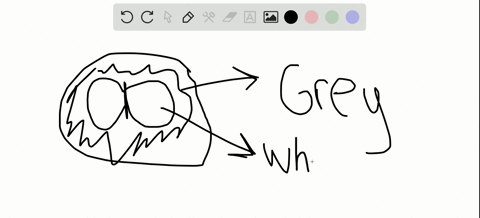 white-matter-is-_____-and-gray-matter-is-_____-a-comprised-of-axons-comprised-of-cell-bodies-and-den