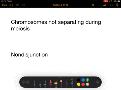 nondisjunction-can-be-caused-by____-a-crossing-over-in-meiosis-b-segregation-in-meiosis-c-failure-of