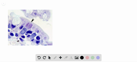 which-of-the-following-is-not-a-characteristic-of-microsporida-a-parasitic-b-lives-in-host-cells-c-m