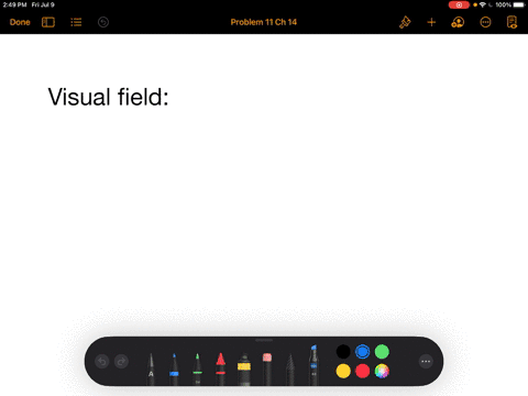 your-visual-field-is-_______-a-a-specific-small-area-of-the-retina-b-what-you-actually-see-c-the-are