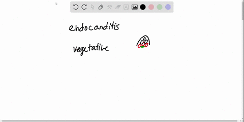 the-type-of-endocarditis-that-develops-slowly-over-a-period-of-weeks-or-months-is-described-as-_____