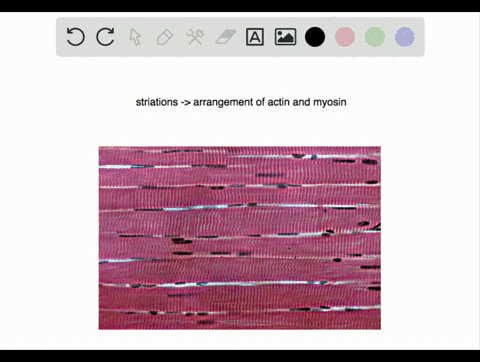 why-does-skeletal-muscle-look-striated