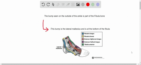 the-bump-seen-on-the-outside-of-the-ankle-is-part-of-the-a-femur-b-tibia-c-fibula-d-tarsal-bones