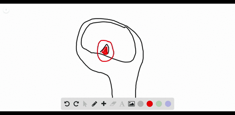 a-pancreas-b-thyroid-c-anterior-pituitary-d-posterior-pituitary-e-hypothalamus-bridge-between-nervou