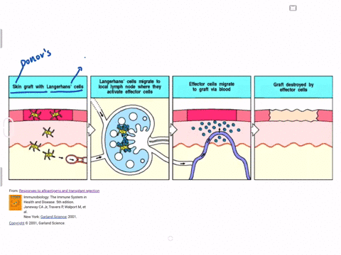different-mhc-class-i-molecules-between-donor-and-recipient-cells-can-lead-to-rejection-of-a-transpl