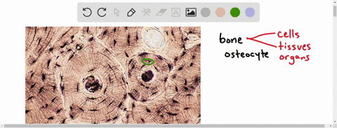 bone-tissue-contains-____-a-living-cells-b-collagen-fibers-c-calcium-and-phosphorus-d-all-of-these-e