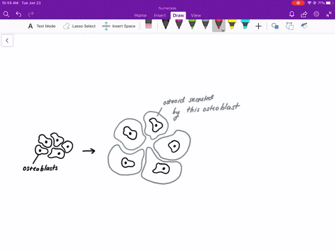 why-are-osteocytes-spread-out-in-bone-tissue-a-they-develop-from-mesenchymal-cells-b-they-are-surrou