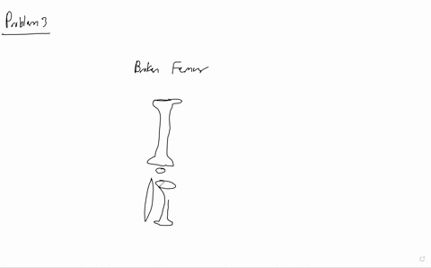 suppose-a-young-boy-severely-fractures-his-femur-describe-how-the-injury-could-affect-his-growth-2