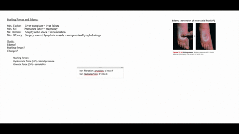 edema-is-a-common-clinical-problem-on-your-first-day-of-a-clinical-rotation-you-encounter-four-patie