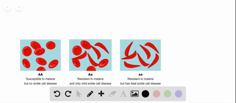the-continued-occurrence-of-sickle-cell-disease-with-malaria-in-parts-of-africa-is-due-to-a-continua