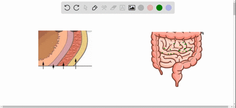 the-tissue-layers-of-the-gi-tract-are-the-a-mucosa-submucosa-muscularis-and-serosa-b-mucosa-villi-an