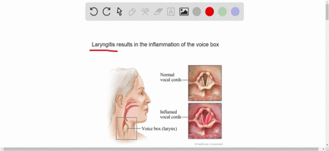 _______-results-from-an-inflammation-of-the-voice-box