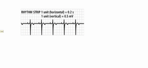 SOLVED:Heart Rate The following graph shows a person’s heart rate while ...