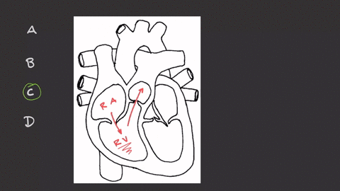 where-does-the-right-ventricle-send-blood-a-the-head-b-the-upper-body-c-the-lungs-d-the-lower-body