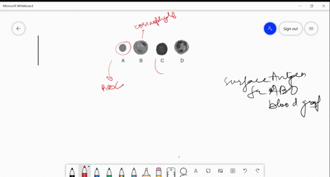 which-cell-represents-the-surface-antigen-for-abo-blood-group-a-mathrma-b-overlinemathrmb-c-mathrmc-