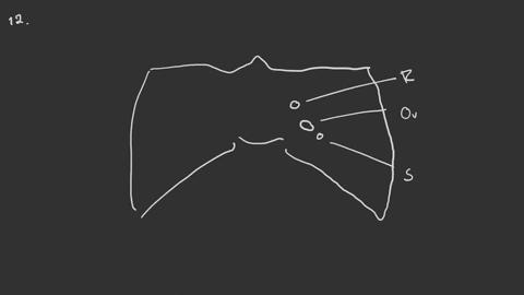 the-middle-cranial-fossa-_________-a-is-bounded-anteriorly-by-the-petrous-ridge-b-is-bounded-posteri
