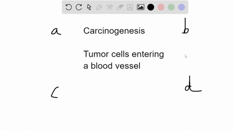 identify-the-stage-of-carcinogenesis-illustrated-below-a-in-situ-b-spreading-c-metastasis-d-tumor-de