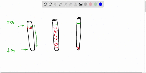 an-inoculated-thioglycolate-medium-culture-tube-shows-dense-growth-at-the-surface-and-turbidity-thro
