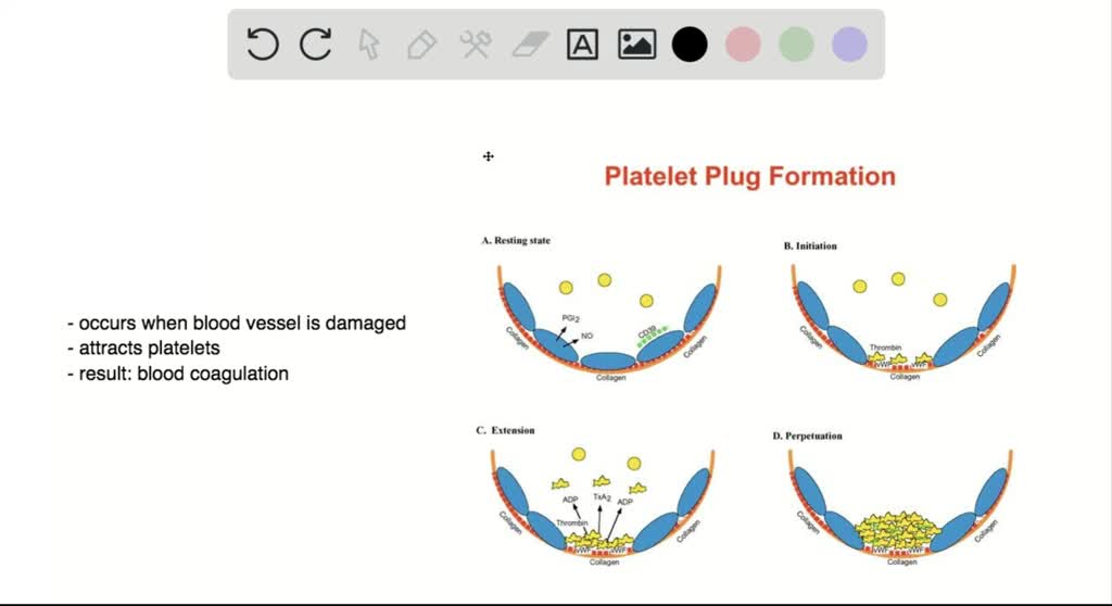 SOLVEDPlatelet plug formation occurs at which point? a. when large