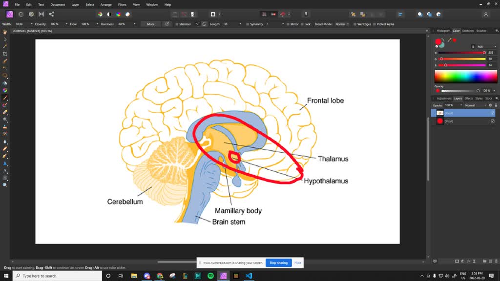 SOLVEDWhich brain structure relays sensory information from the