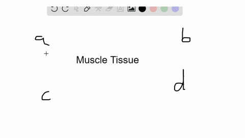 this-form-of-muscle-tissue-is-under-voluntary-control-in-the-body-a-cardiac-muscle-b-skeletal-musc-2