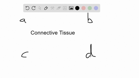 _____-connects-epithelium-to-underlying-connective-tissue-a-gap-junctions-b-basement-membrane-c-kera