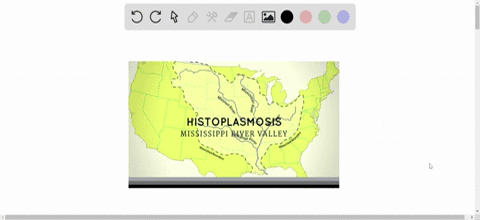 in-the-united-states-most-histoplasmosis-cases-occur-a-in-the-pacific-northwest-b-in-the-desert-sout