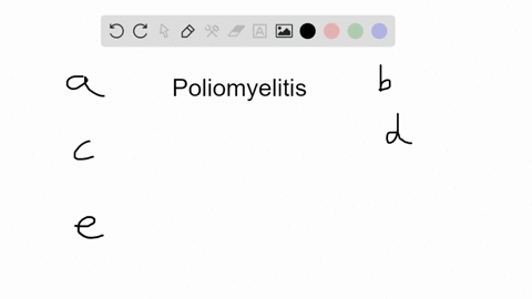 which-of-these-statements-concerning-poliomyelitis-is-false-a-the-sensory-nerves-are-usually-involve