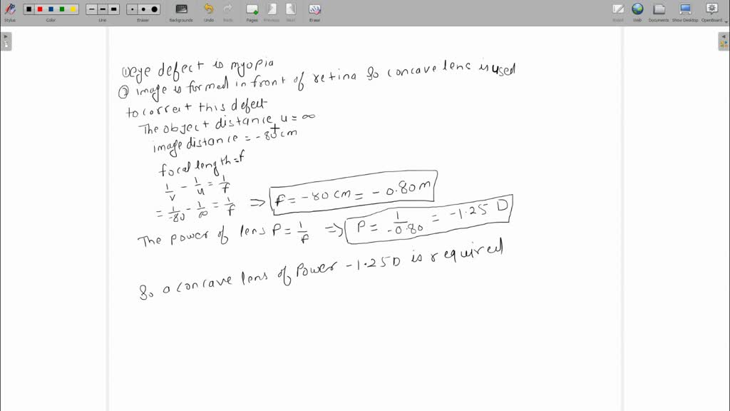 solved-the-far-point-of-a-myopic-person-is-80cm-in-front-of-the-eye
