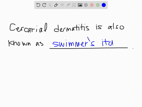 cercarial-dermatitis-is-also-known-as-________