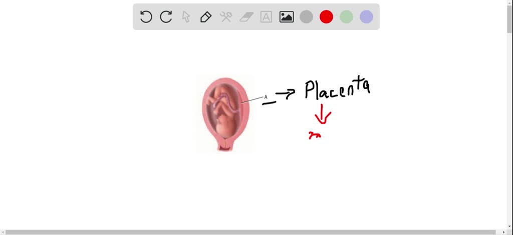 solved-use-the-diagram-below-to-answer-questions-image-cannot-copy