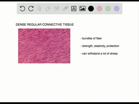 Solved:which Connective Tissue Specializes In Storage Of Fat? A. Tendon B.  Adipose Tissue C. Reticular Tissue D. Dense Connective Tissue Solved:which Connective Tissue Specializes In Storage Of Fat? A. Tendon B.  Adipose Tissue C. Reticular Tissue D. Dense Connective Tissue
