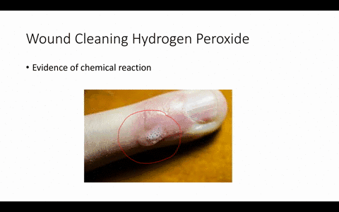 small-cuts-and-abrasions-on-the-skin-are-frequently-cleaned-using-hydrogen-peroxide-solution-what-ev