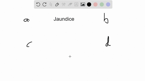 jaundice-is-caused-by-the-presence-of-__________-in-the-blood-plasma-which-is-a-breakdown-product-of