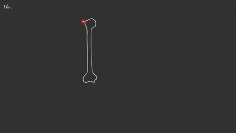 which-bony-landmark-is-located-on-the-lateral-side-of-the-proximal-humerus-a-greater-tubercle-b-troc