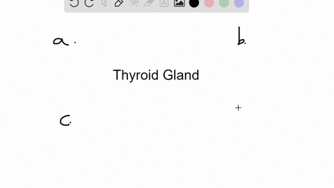 which-of-the-following-statements-about-the-thyroid-gland-is-true-a-it-is-located-anterior-to-the-tr
