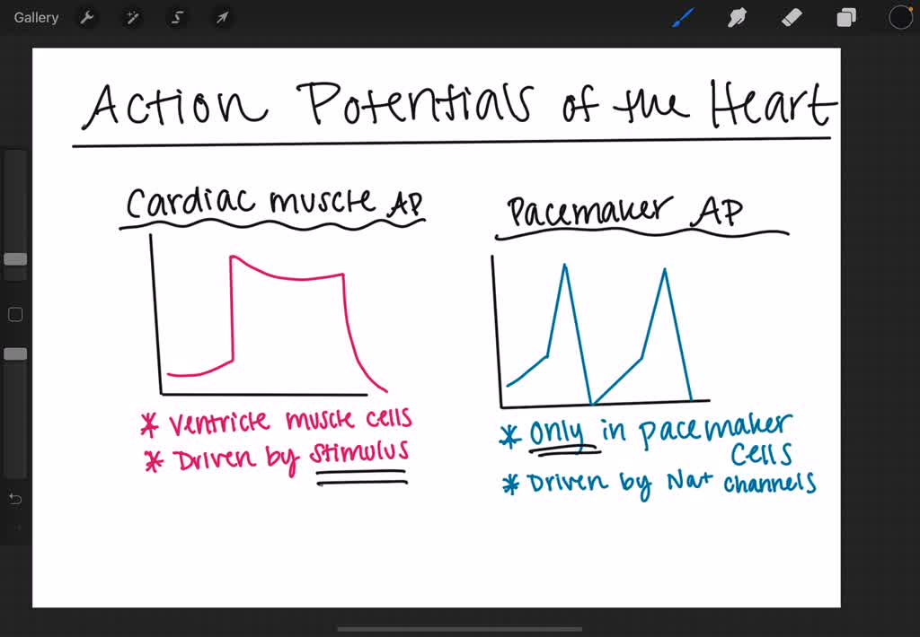 SOLVED:The Pacemaker Action Potentials In The Heart A. Are Due To ...