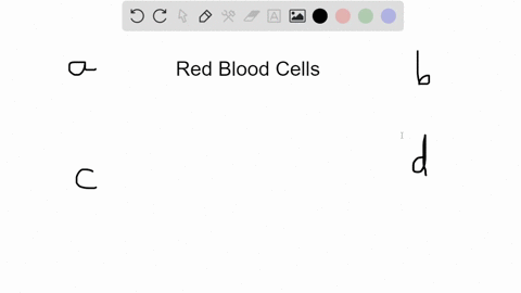 a-deficiency-of-red-blood-cells-would-result-in-a-fatigue-and-dizziness-b-bleeding-and-bruising-c-in