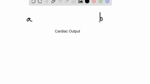 in-a-healthy-young-adult-what-happens-to-cardiac-output-when-heart-rate-increases-above-160-bpm-a-it