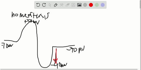 what-is-the-difference-between-a-hyperpolarization-and-a-depolarization-5