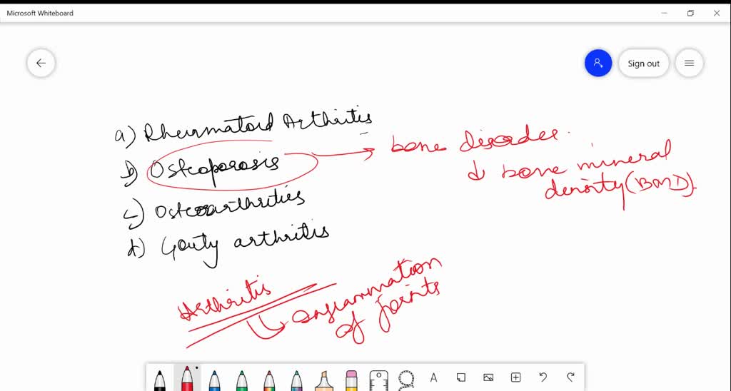 SOLVEDtoid arthres Imbalances of certain hormones, deficiencies and