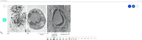 look-carefully-at-the-electron-micrographs-in-figure-18-38-describe-the-differences-between-the-cell