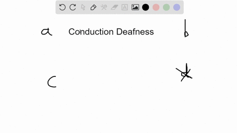conduction-deafness-would-most-likely-be-caused-by-damage-to-the-a-cochlear-nerve-b-malleus-incus-an