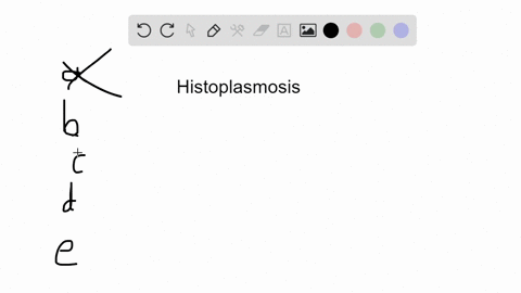 the-disease-histoplasmosis-a-is-caused-by-an-encapsulated-bacterium-b-is-contracted-by-inhaling-arth
