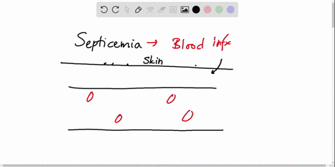 how-is-septicemia-introduced-into-the-body-a-food-b-sexual-contact-c-direct-inoculation-into-the-blo