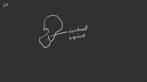 the-ischial-spine-is-found-between-which-of-the-following-structures-a-inferior-pubic-ramus-and-isch