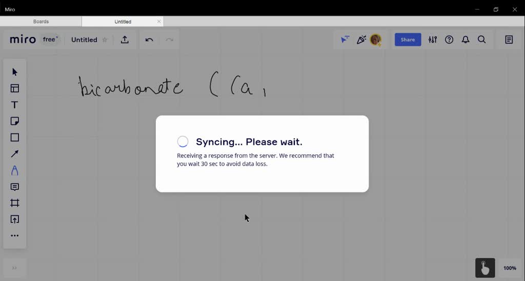 SOLVEDHardness of water is estimated by simple complex formation